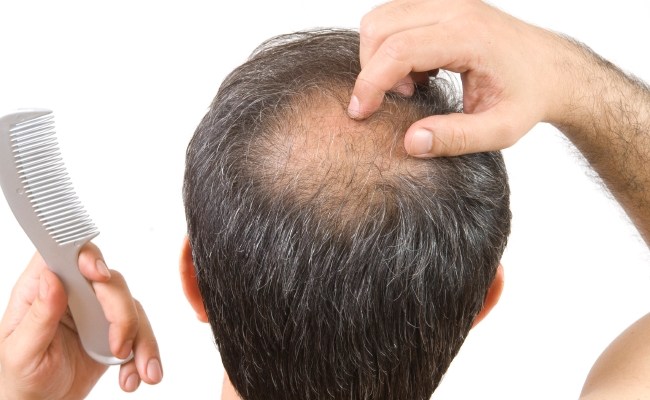 Improve Scalp condition and Blood Circulation
