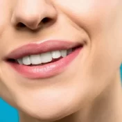 How-to-Close-a-Gap-in-Your-Teeth
