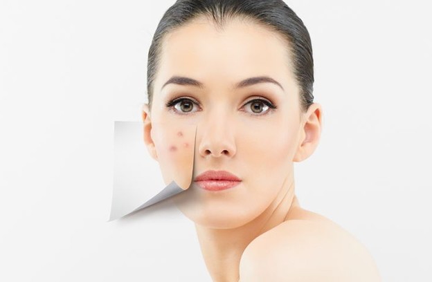 Weapons And Strategies In Fighting Acne