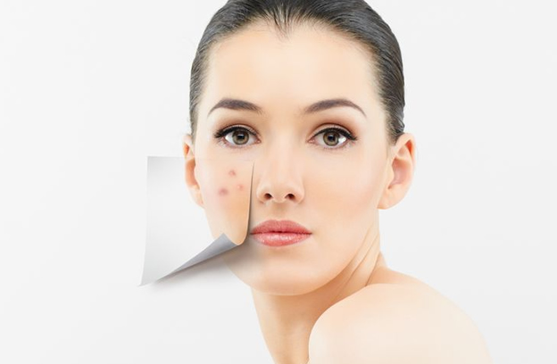 Weapons and Strategies in Fighting Acne