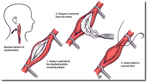 Vascular-Surgery