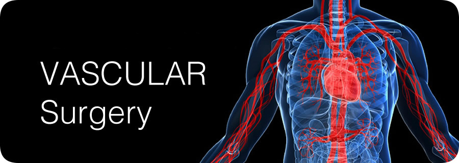 Vascular-Surgery