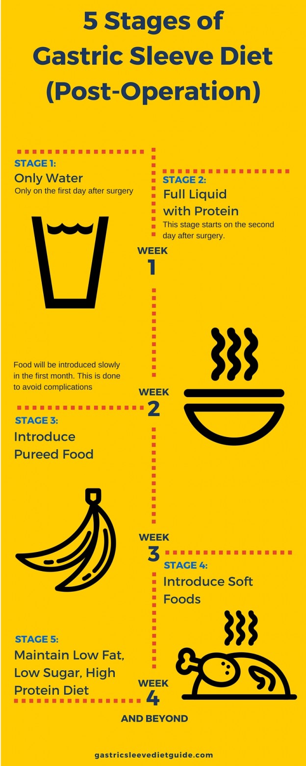 Benefits Of Using Gastric Sleeve Diet For Weight Loss