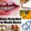 Perfect Home Remedies for Mouth Ulcers