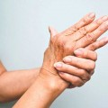 Everything You Need to Know About Arthritis