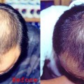 Tips to Naturally Regrow Your Hair