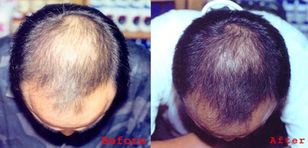 3 Tips To Naturally Regrow Your Hair