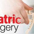 Bariatric Surgery