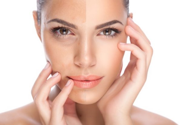 How To Get Clear, Spotless Skin