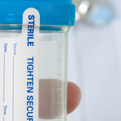 Pass a Urine Drug Test Fast