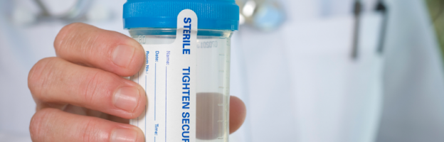 How To Pass A Urine Drug Test Fast