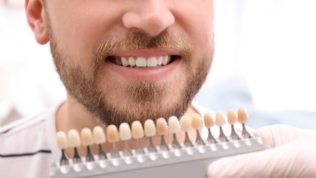 How Long Does Rowley Regis Teeth Whitening Last?