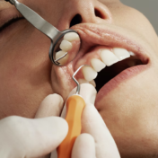 Dental Care in Raleigh