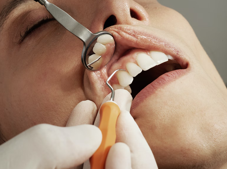 Dental Care in Raleigh