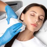 laser hair removal