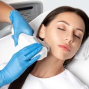 laser hair removal